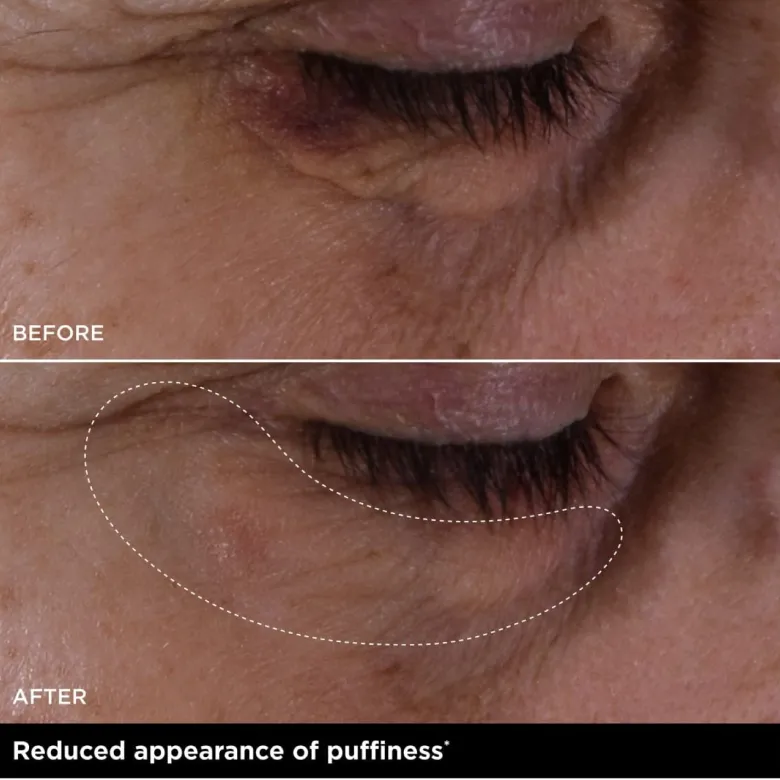 Double Serum Eye New