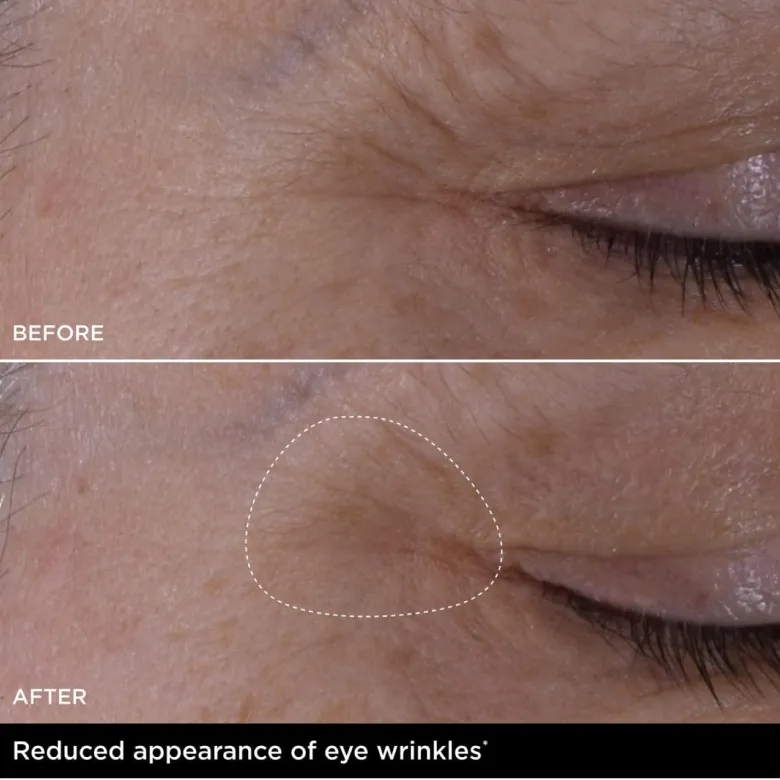 Double Serum Eye New