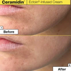 Dr.Jart+ Ceramidin Ectoin-Infused Cream
