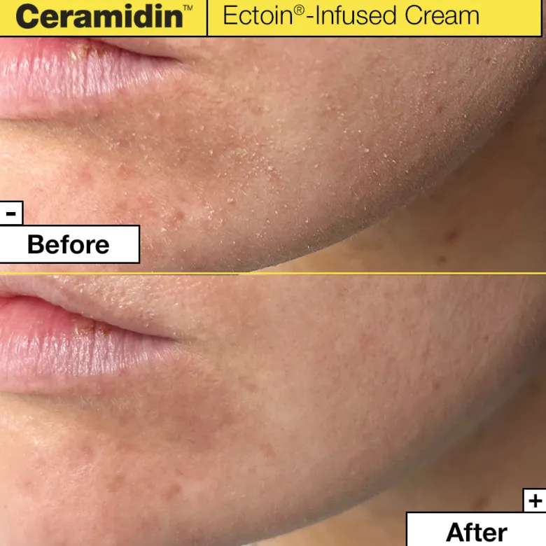 Dr.Jart+ Ceramidin Ectoin-Infused Cream
